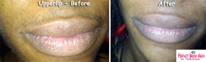 Lips Threading Before After